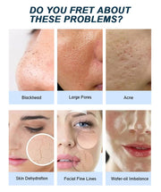 Kaylite Salicylic Acid Facewash for soft and flawless skin