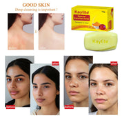 Kaylite Natural Kanchan Soap for Soft Skin